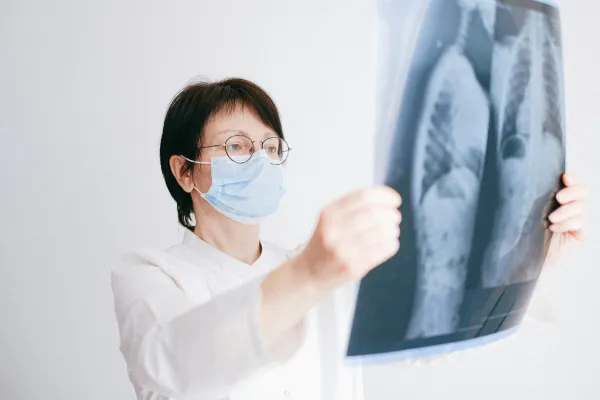 GPT-4 Matches Radiologists in Detecting Radiology Report Errors